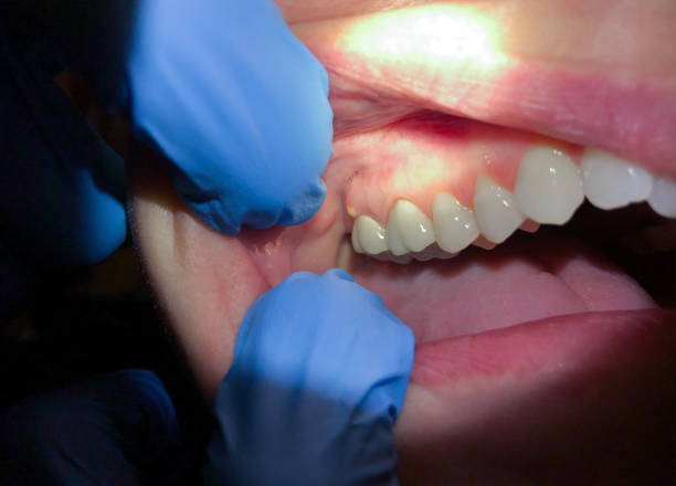 Best After-Hours Dental Trauma Care in Candor, NC